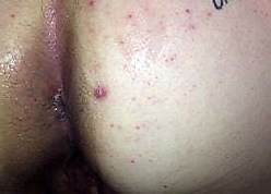 Pooping Cum inspection Anal