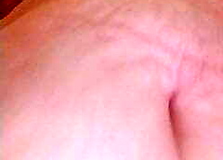 SSBBW Intestines Turn